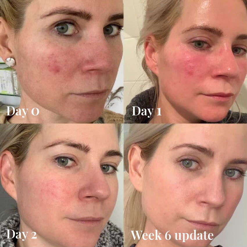 Omnilux Contour Face