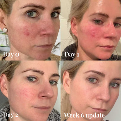 Omnilux Contour Face